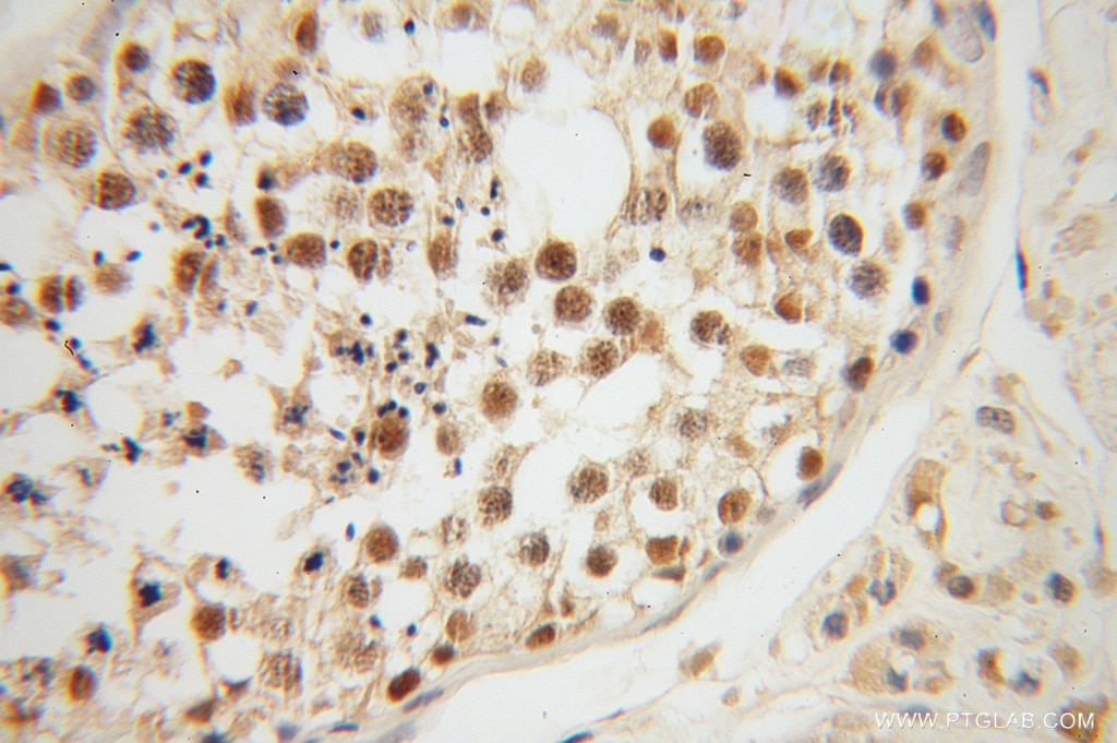 IHC staining of human testis using 13709-1-AP