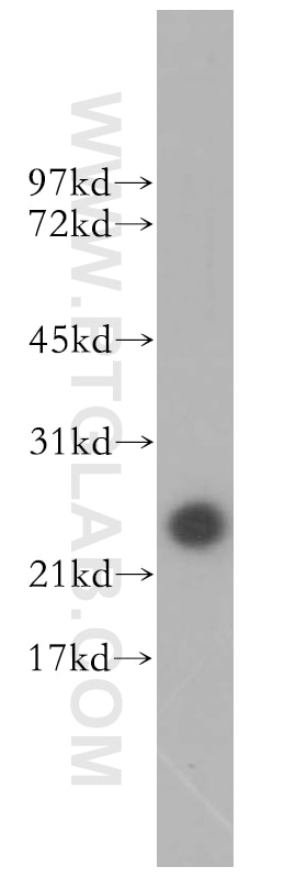 Western Blot (WB) analysis of mouse testis tissue using TCP10L Polyclonal antibody (13709-1-AP)