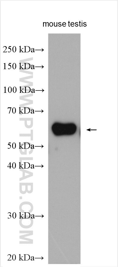 Western Blot (WB) analysis of various lysates using TCP11 Polyclonal antibody (14606-1-AP)