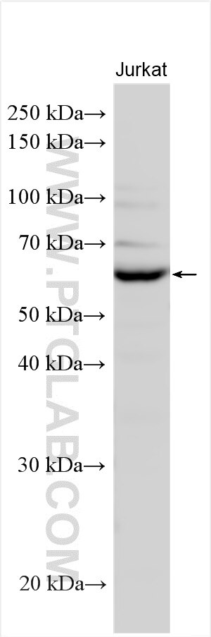 Western Blot (WB) analysis of various lysates using TCP11L1 Polyclonal antibody (17493-1-AP)