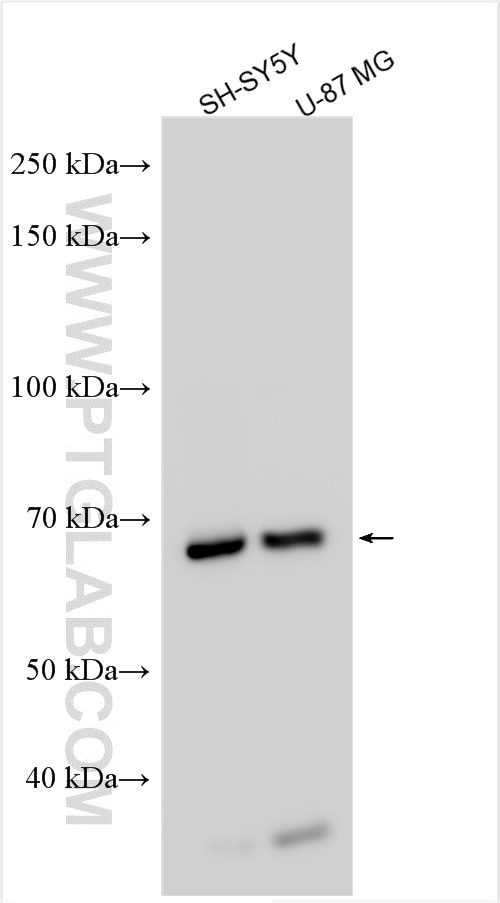Western Blot (WB) analysis of various lysates using TCP11L2 Polyclonal antibody (17377-1-AP)