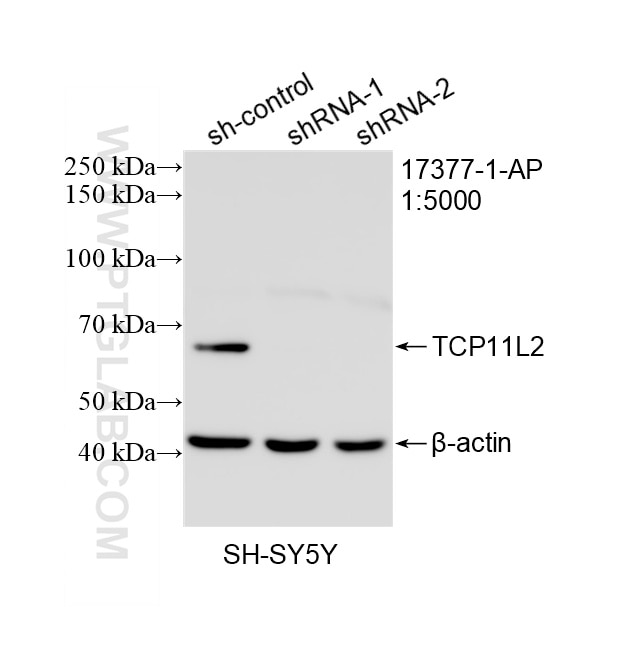 Western Blot (WB) analysis of SH-SY5Y cells using TCP11L2 Polyclonal antibody (17377-1-AP)