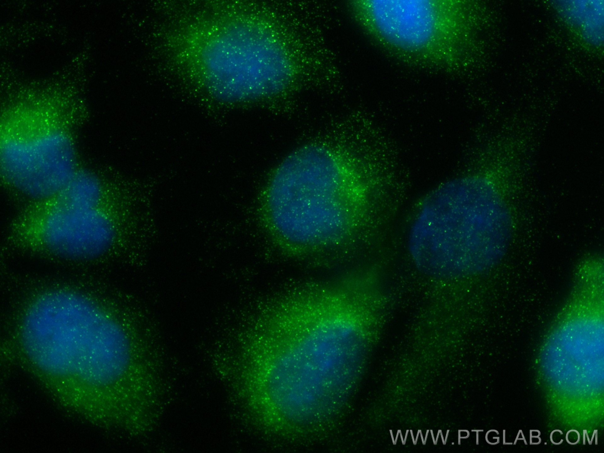 Immunofluorescence (IF) / fluorescent staining of U-251 cells using TCP11L2 Recombinant antibody (83227-1-RR)