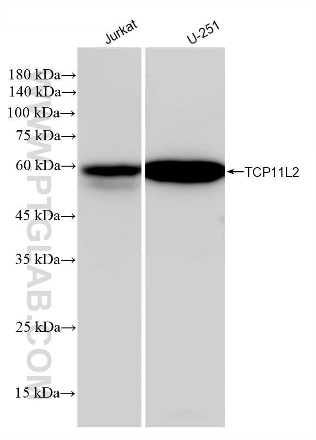 Western Blot (WB) analysis of various lysates using TCP11L2 Recombinant antibody (83227-1-RR)