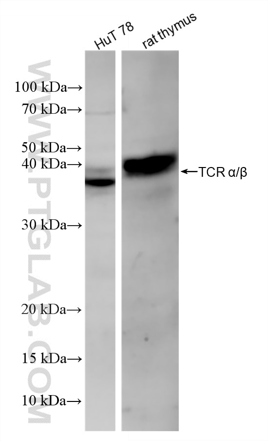 Western Blot (WB) analysis of various lysates using TCR α/β Recombinant monoclonal antibody (87509-1-RR)