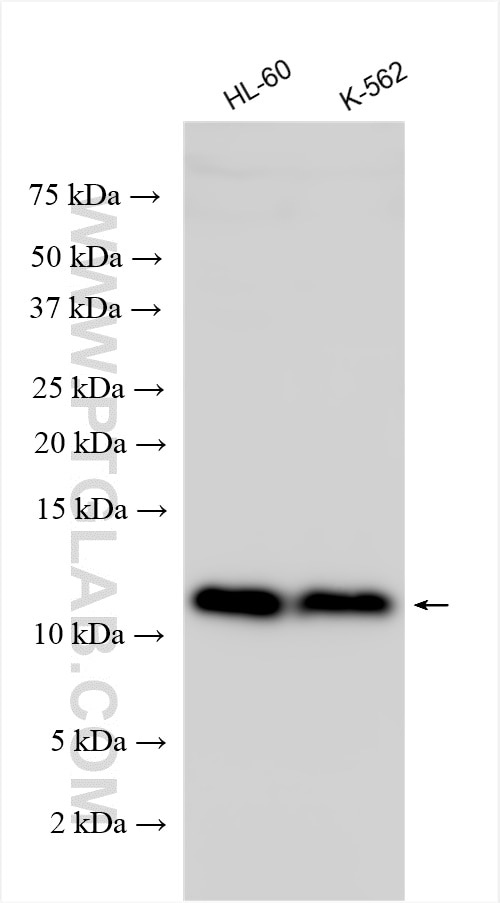 Western Blot (WB) analysis of various lysates using TCTA Polyclonal antibody (15221-1-AP)