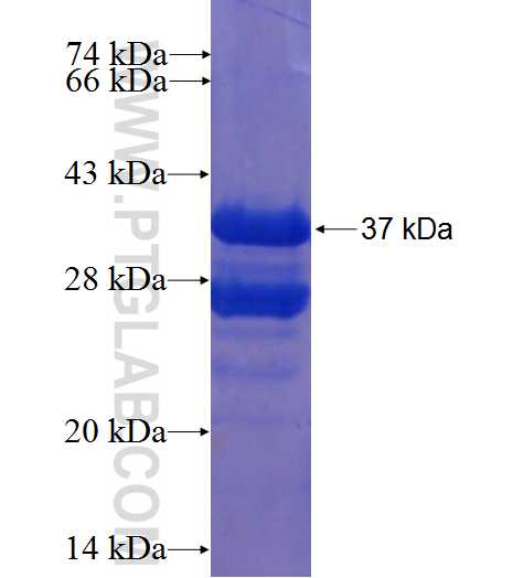 TCTA fusion protein Ag7425 SDS-PAGE