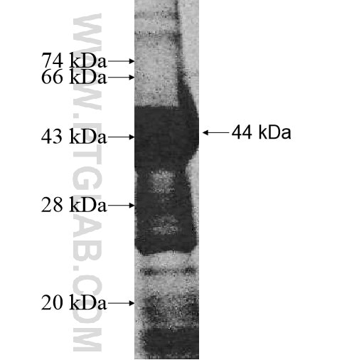 TCTE1 fusion protein Ag10759 SDS-PAGE