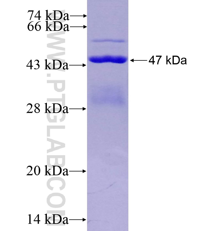 TCTEX1D1 fusion protein Ag16244 SDS-PAGE