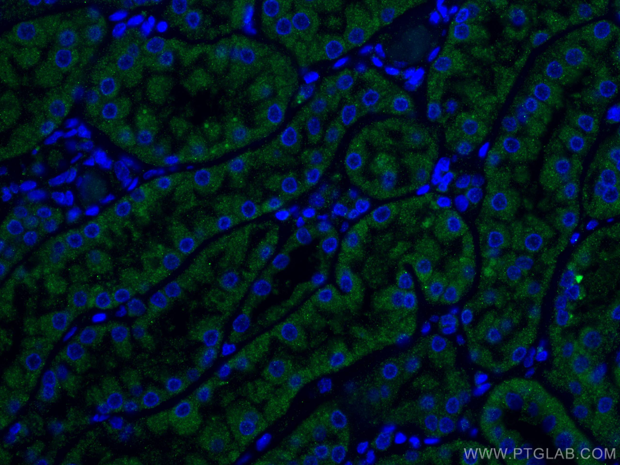 Immunofluorescence (IF) / fluorescent staining of human kidney tissue using TCTN1 Polyclonal antibody (15004-1-AP)