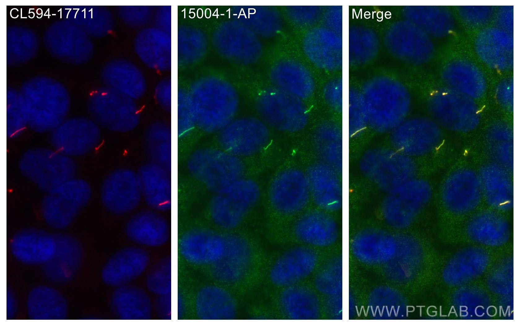 Immunofluorescence (IF) / fluorescent staining of hTERT-RPE1 cells using TCTN1 Polyclonal antibody (15004-1-AP)