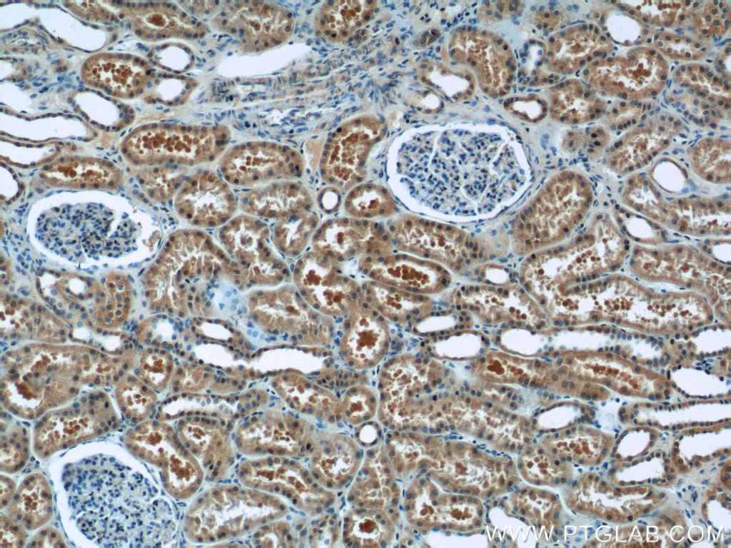 Immunohistochemistry (IHC) staining of human kidney tissue using TCTN1 Polyclonal antibody (15004-1-AP)