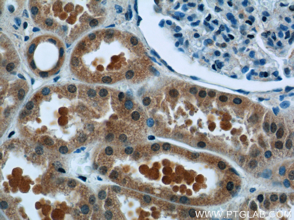 Immunohistochemistry (IHC) staining of human kidney tissue using TCTN1 Polyclonal antibody (15004-1-AP)