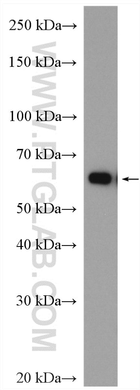 Western Blot (WB) analysis of fetal human brain tissue using TCTN1 Polyclonal antibody (15004-1-AP)