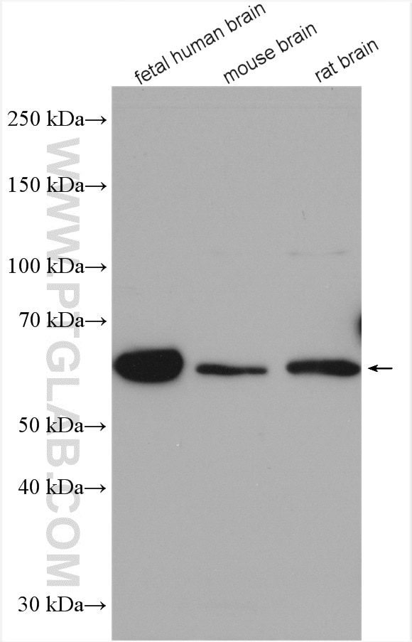 Western Blot (WB) analysis of various lysates using TCTN1 Polyclonal antibody (15004-1-AP)