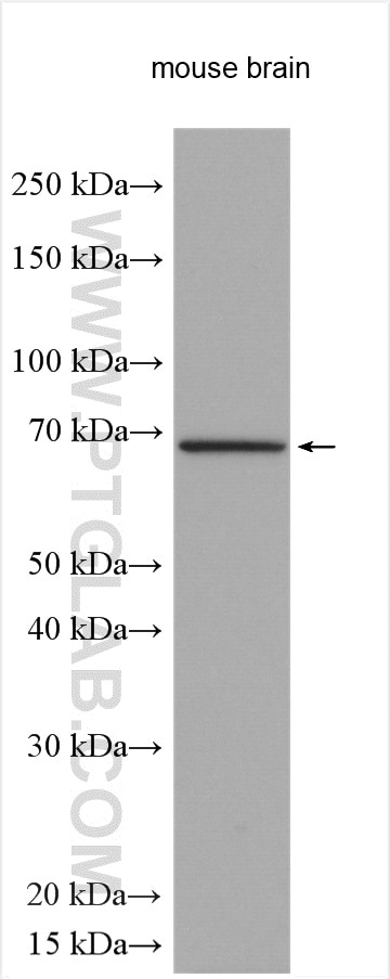 Western Blot (WB) analysis of various lysates using TCTN1 Polyclonal antibody (28630-1-AP)