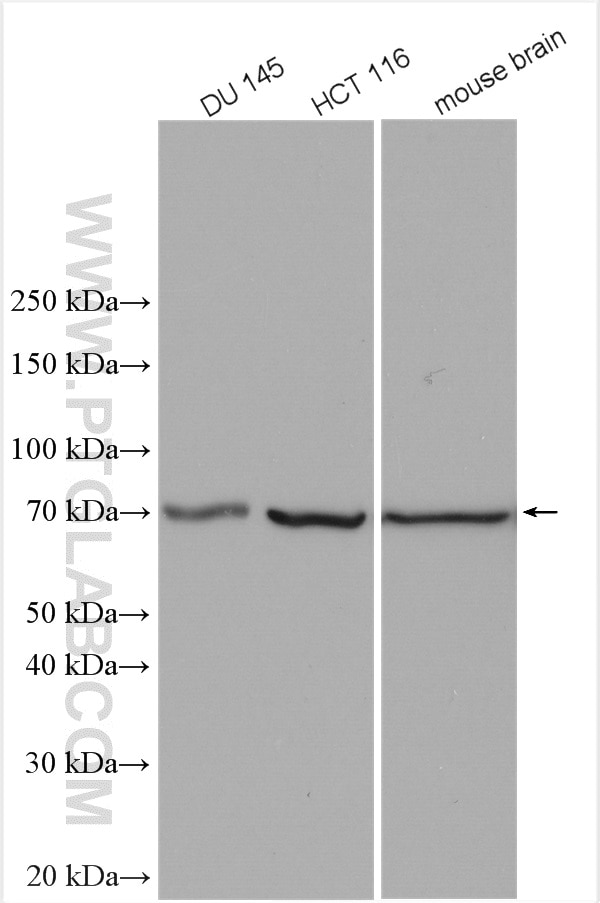 Western Blot (WB) analysis of various lysates using TCTN1 Polyclonal antibody (28630-1-AP)