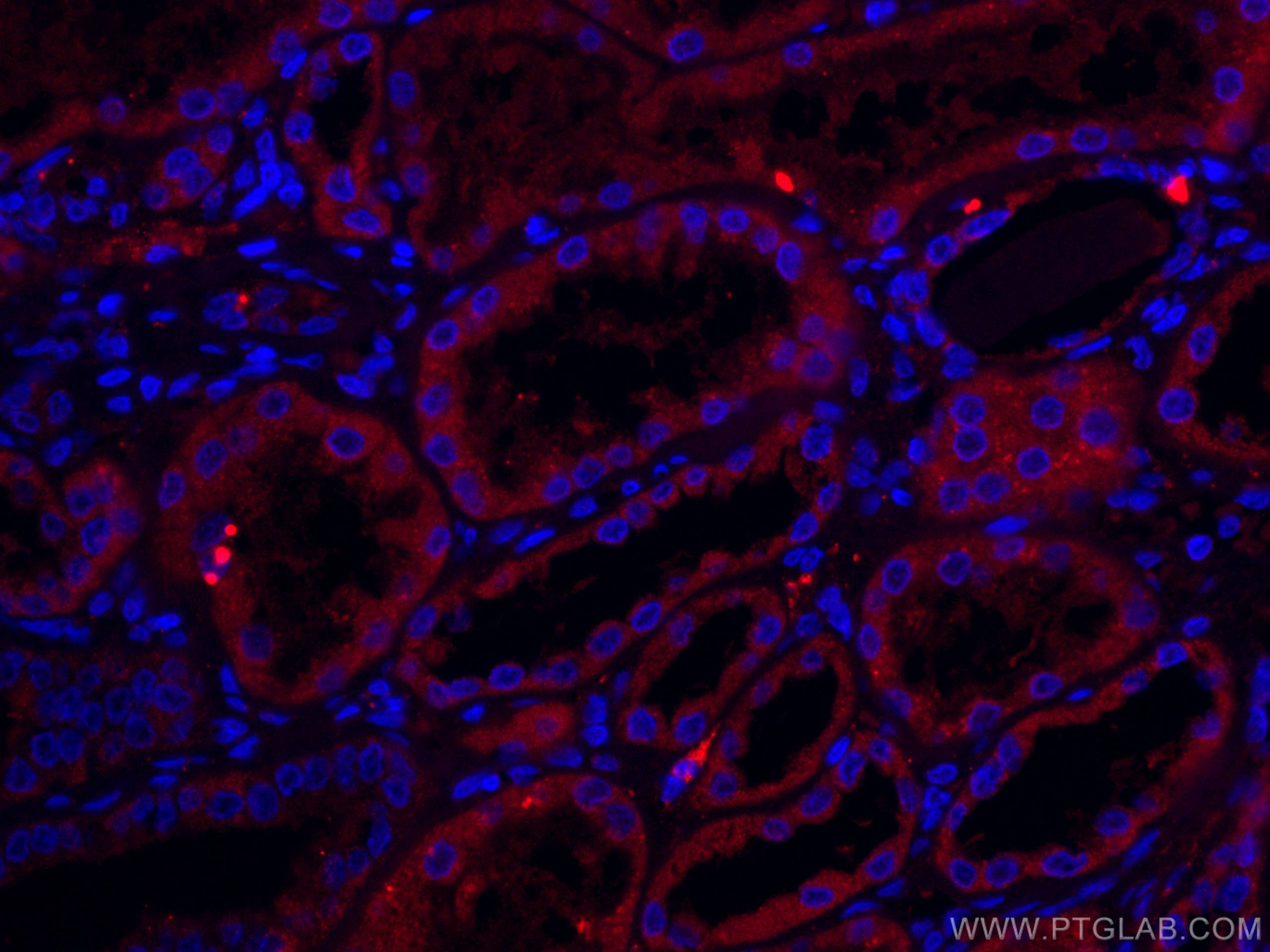 Immunofluorescence (IF) / fluorescent staining of human kidney tissue using CoraLite®594-conjugated TCTN1 Polyclonal antibody (CL594-15004)