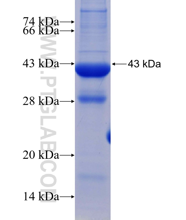 TCTN1 fusion protein Ag30064 SDS-PAGE