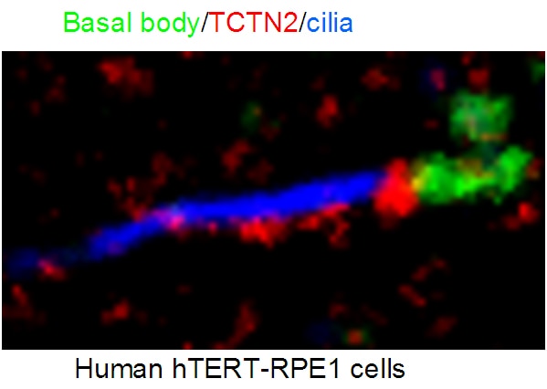 TCTN2 Polyclonal antibody