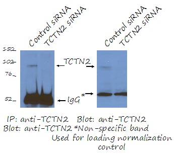 TCTN2
