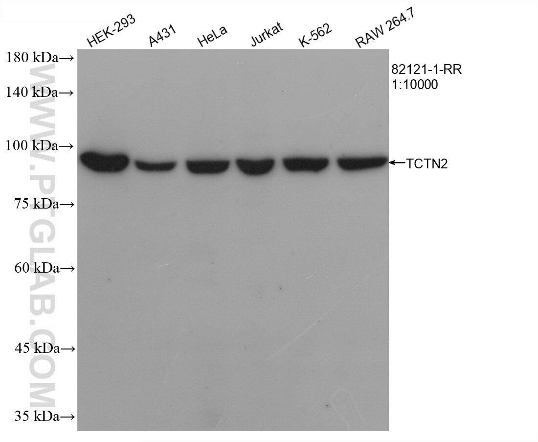 Western Blot (WB) analysis of various lysates using TCTN2 Recombinant antibody (82121-1-RR)