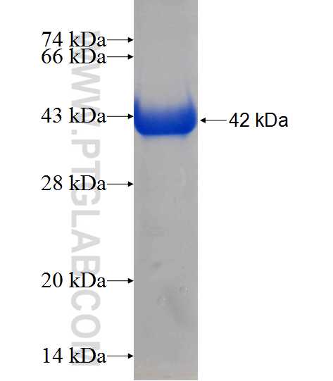 TCTN2 fusion protein Ag10725 SDS-PAGE