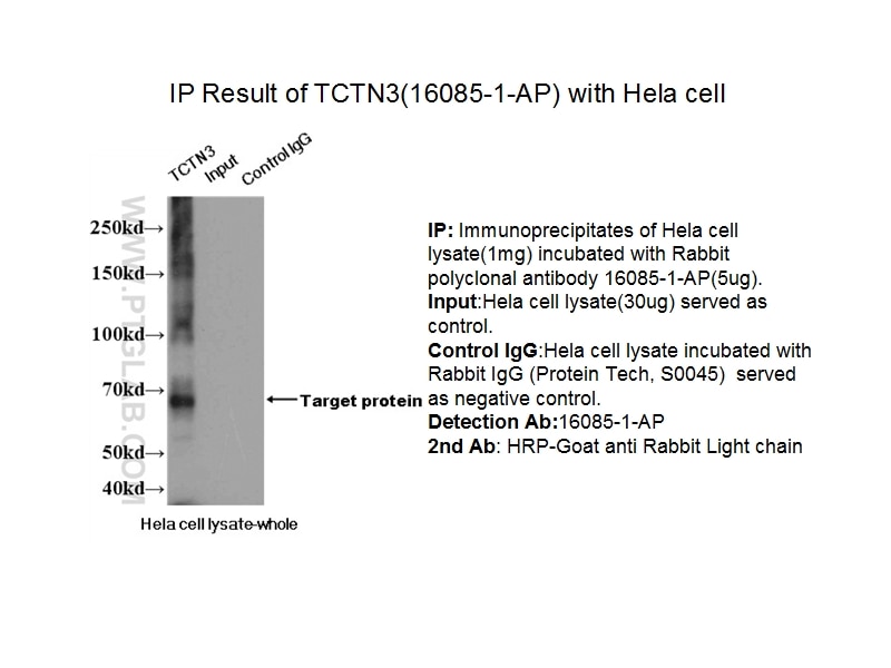 Immunoprecipitation (IP) experiment of Hela cells using TCTN3 Polyclonal antibody (16085-1-AP)