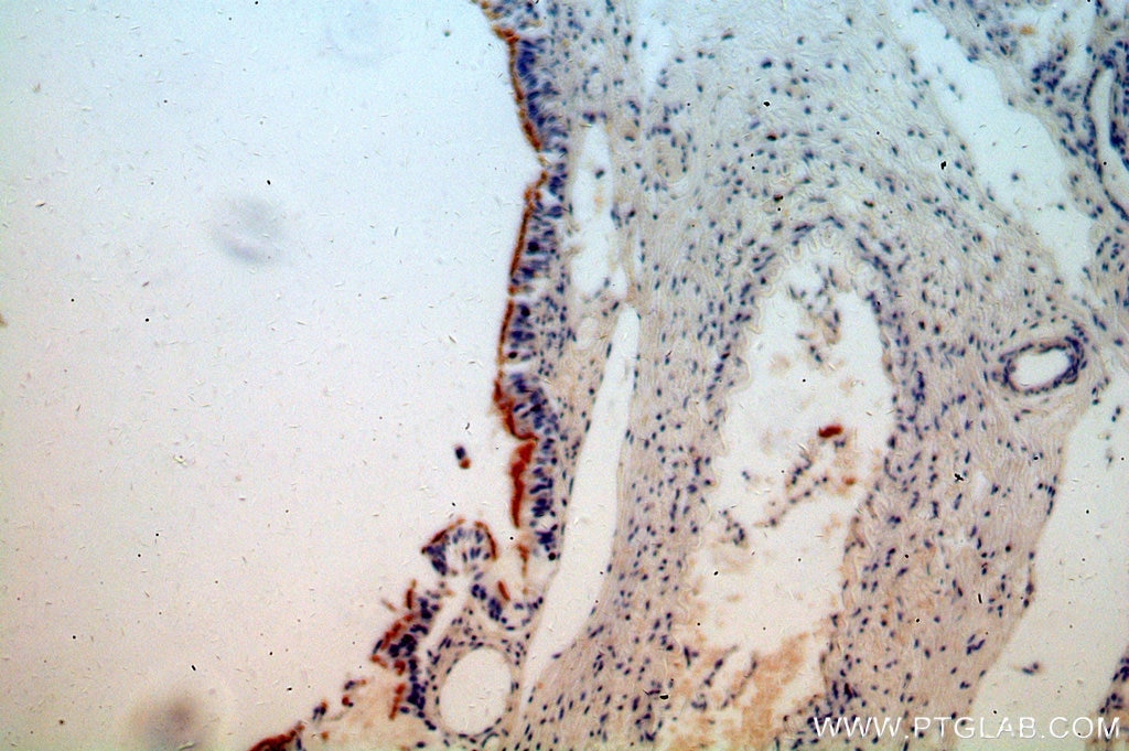 Immunohistochemistry (IHC) staining of human lung tissue using TCTN3 Polyclonal antibody (16085-1-AP)