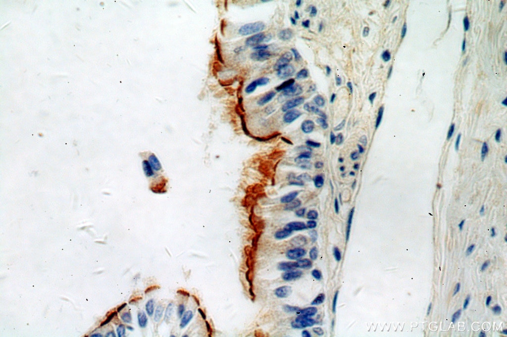 Immunohistochemistry (IHC) staining of human lung tissue using TCTN3 Polyclonal antibody (16085-1-AP)