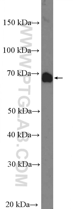 Western Blot (WB) analysis of mouse liver tissue using TCTN3 Polyclonal antibody (16085-1-AP)