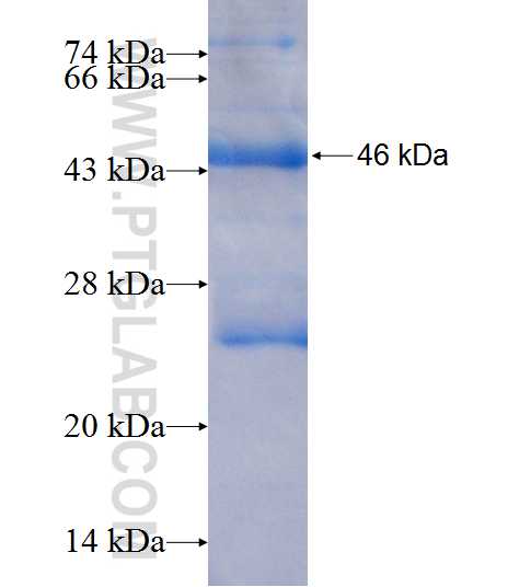 TCTN3 fusion protein Ag9106 SDS-PAGE