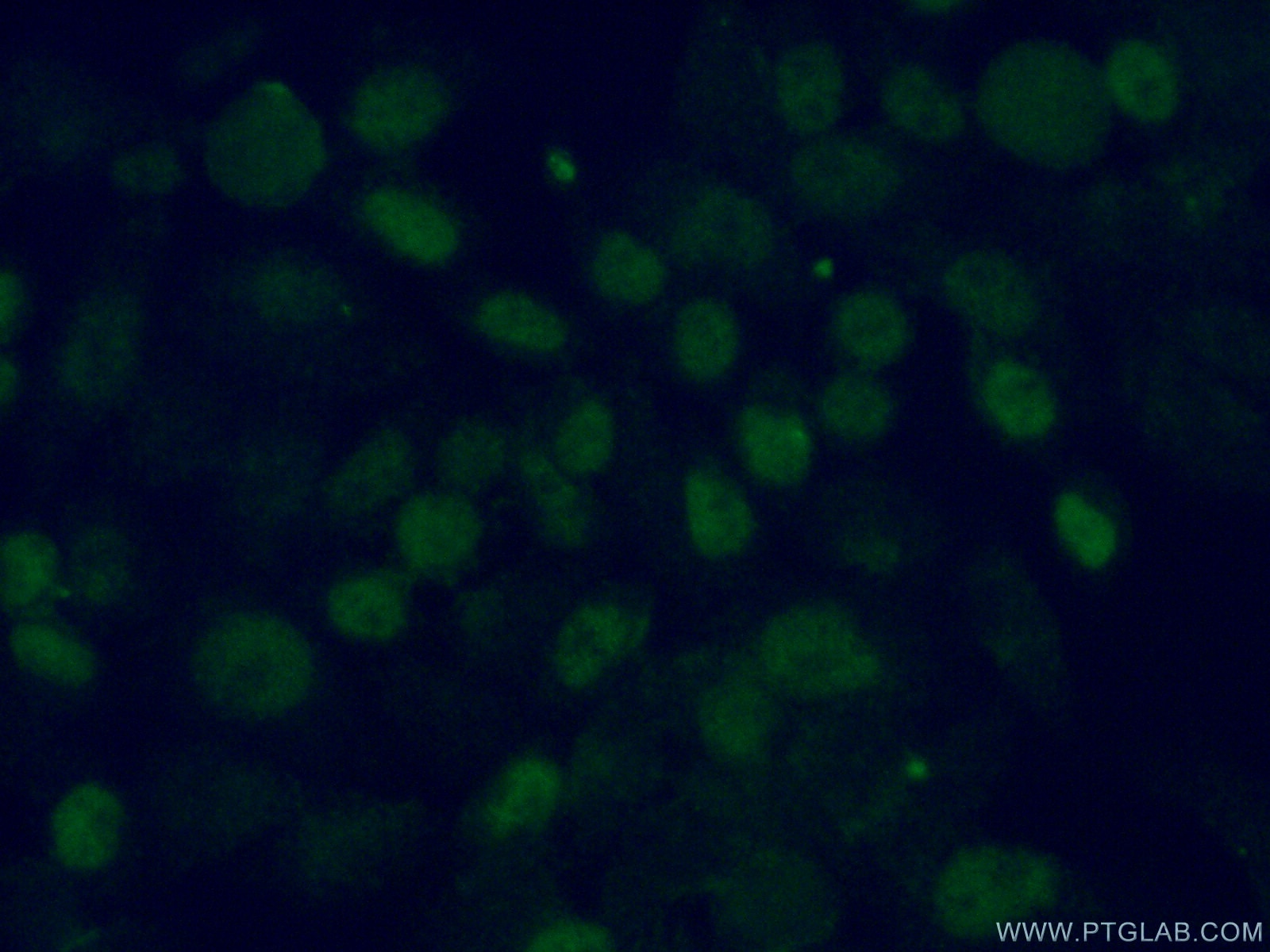 Immunofluorescence (IF) / fluorescent staining of HeLa cells using TDG Polyclonal antibody (13370-1-AP)
