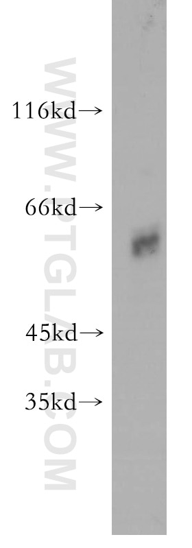 Western Blot (WB) analysis of mouse colon tissue using TDG Polyclonal antibody (13370-1-AP)