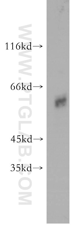 WB analysis of mouse colon using 13370-1-AP