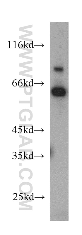Western Blot (WB) analysis of HeLa cells using TDG Polyclonal antibody (13370-1-AP)