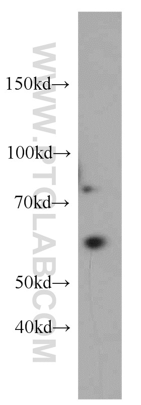 Western Blot (WB) analysis of Raji cells using TDG Polyclonal antibody (13370-1-AP)