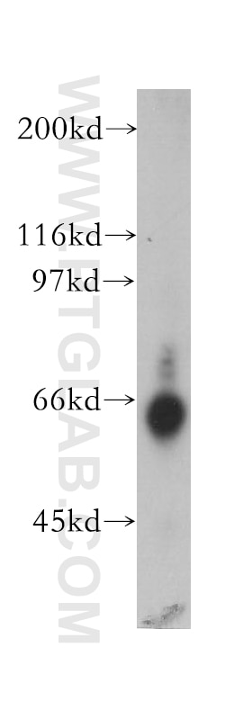 Western Blot (WB) analysis of human brain tissue using TDG Polyclonal antibody (13370-1-AP)