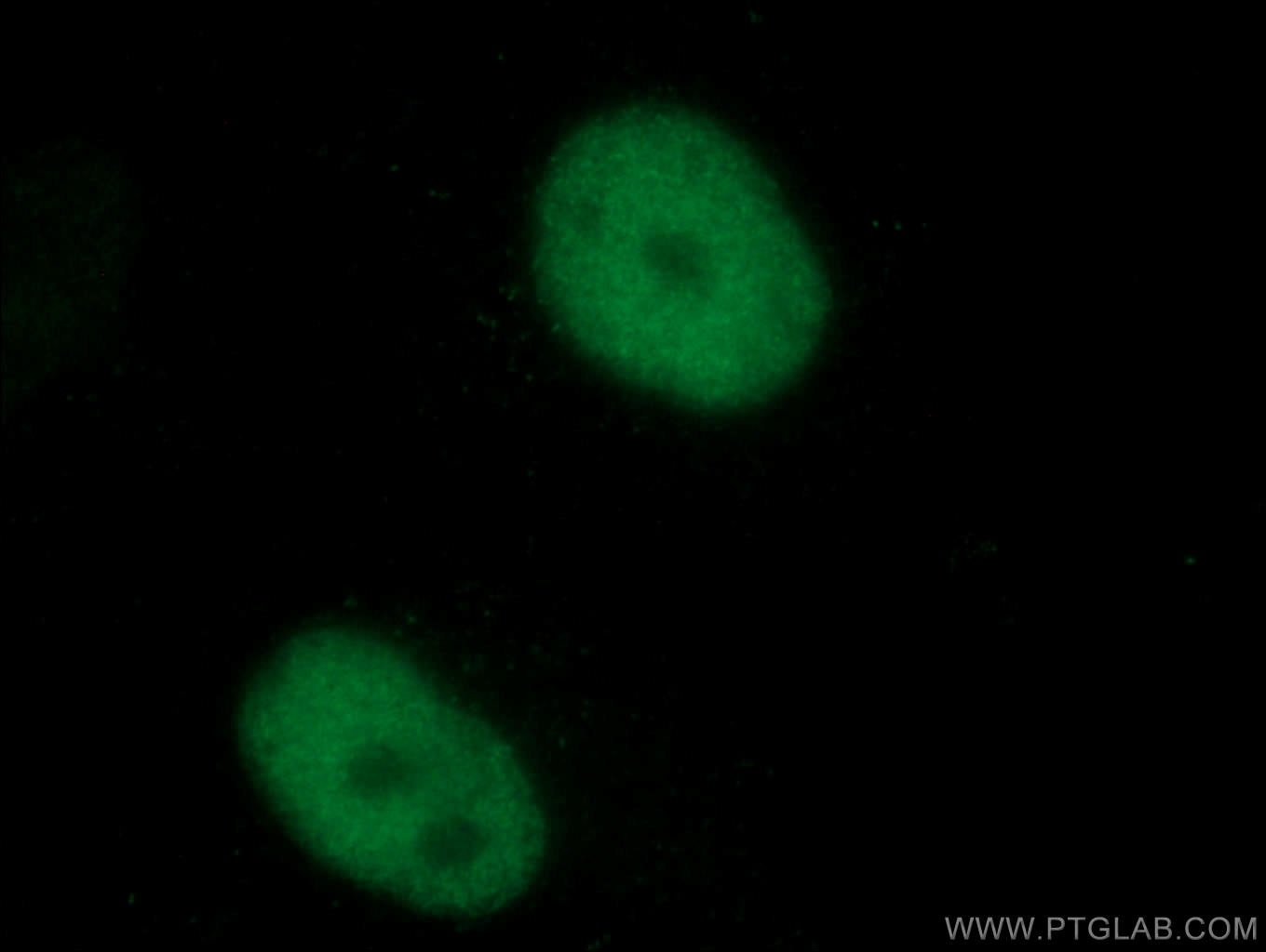Immunofluorescence (IF) / fluorescent staining of HepG2 cells using TDG Monoclonal antibody (66707-1-Ig)