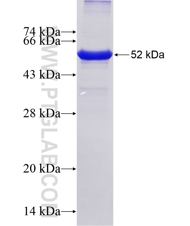 TDG fusion protein Ag27408 SDS-PAGE