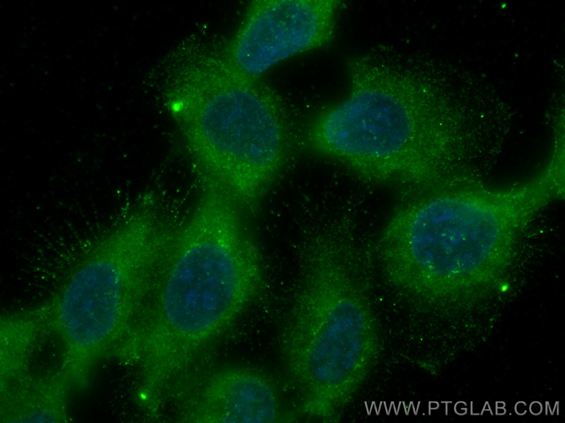Immunofluorescence (IF) / fluorescent staining of A431 cells using TDO2 Polyclonal antibody (15880-1-AP)