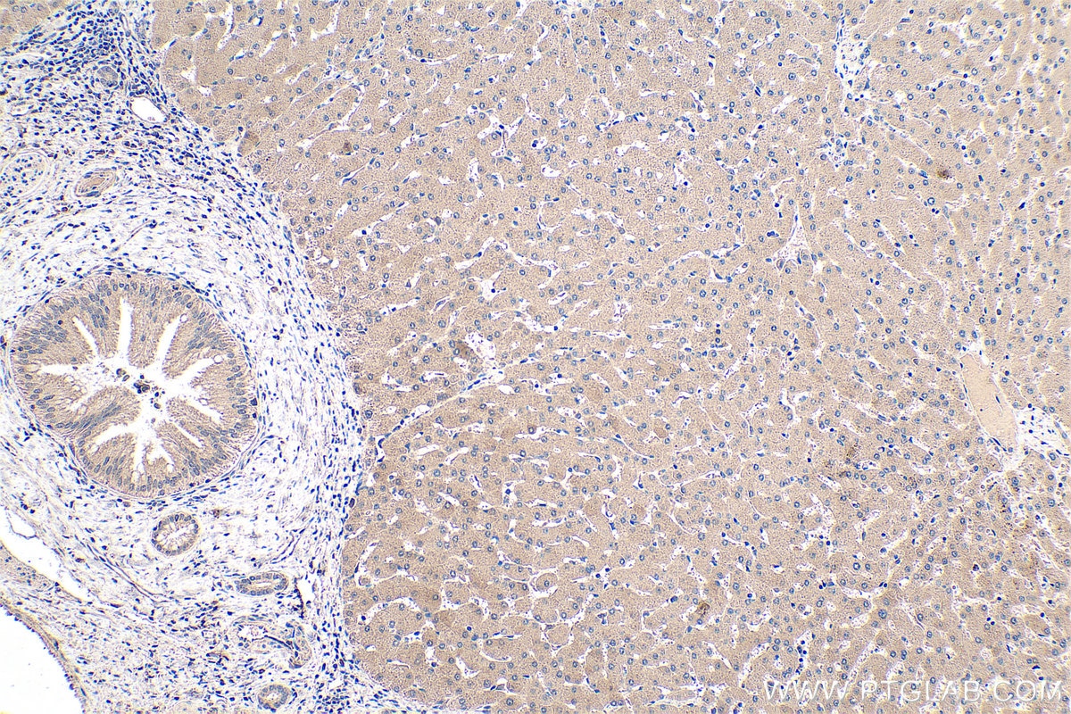 Immunohistochemistry (IHC) staining of human liver tissue using TDO2 Polyclonal antibody (15880-1-AP)