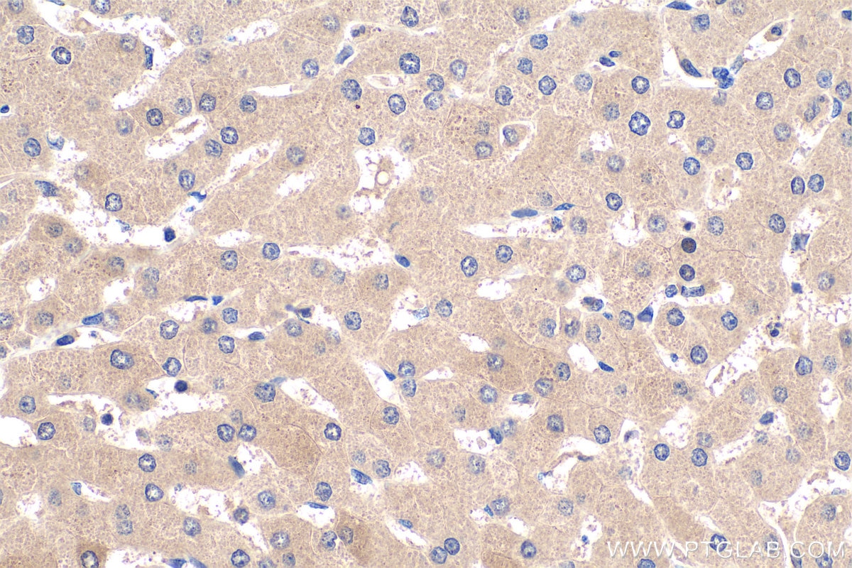 Immunohistochemistry (IHC) staining of human liver tissue using TDO2 Polyclonal antibody (15880-1-AP)