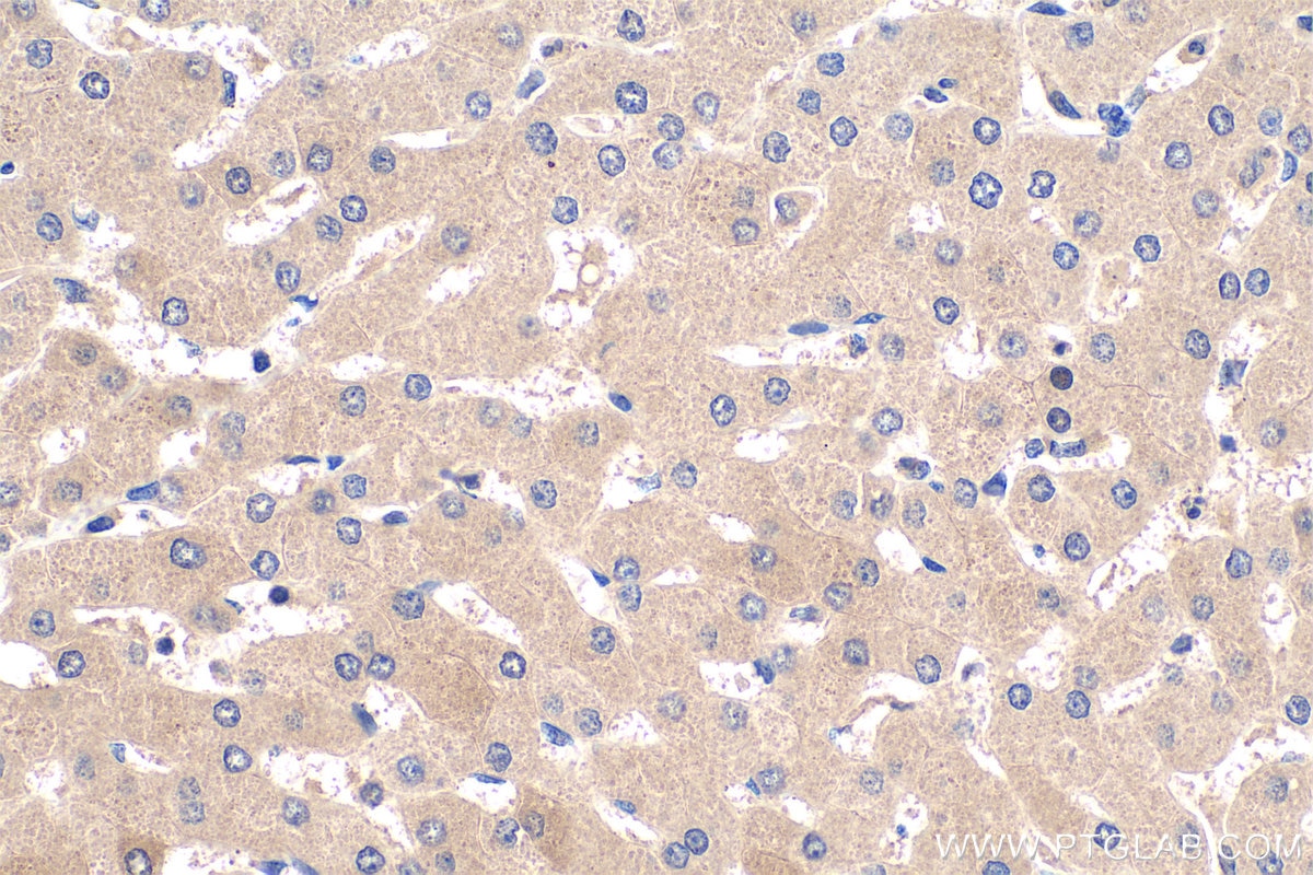 IHC staining of human liver using 15880-1-AP