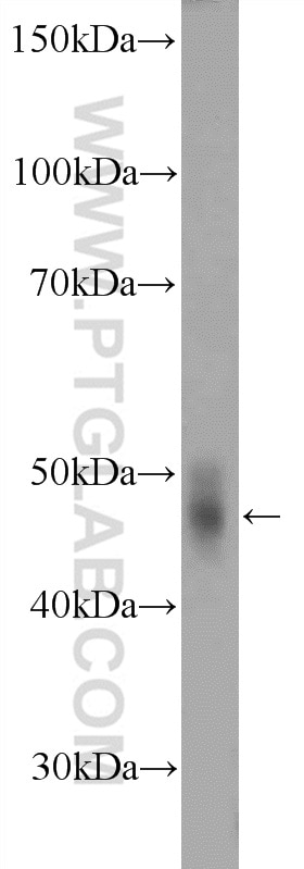 TDO2 Polyclonal antibody