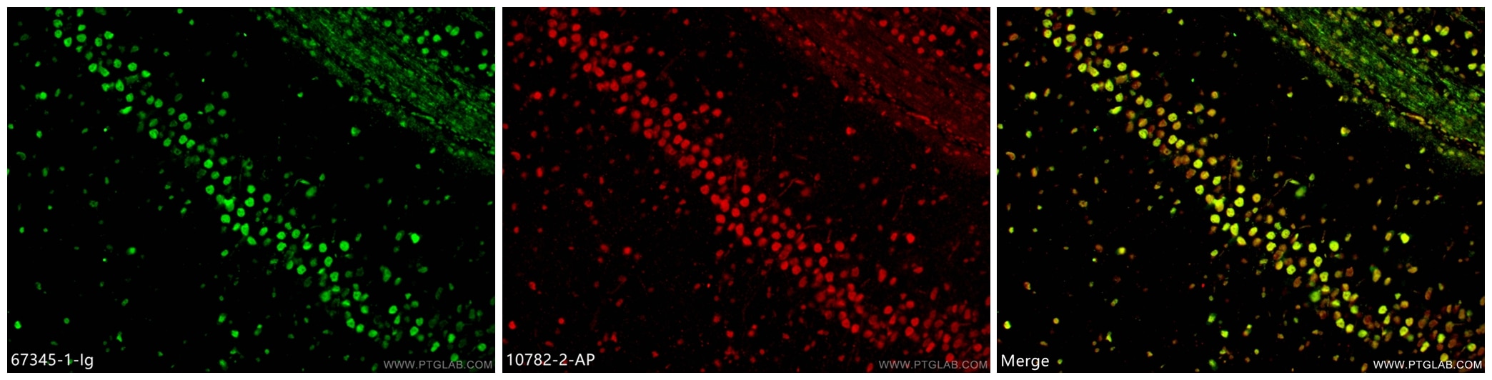 Immunofluorescence (IF) / fluorescent staining of rat brain tissue using TDP-43 (C-terminal) Monoclonal antibody (67345-1-Ig)
