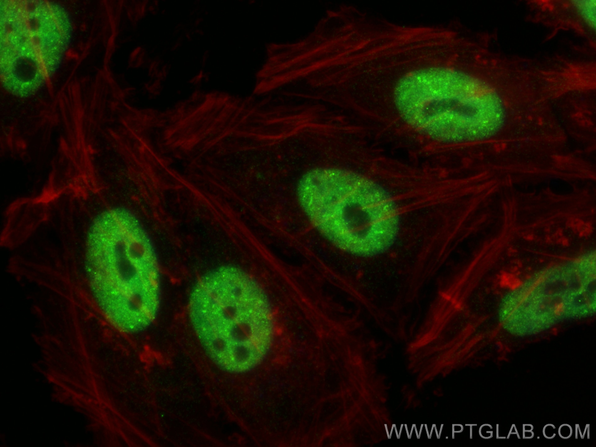 Immunofluorescence (IF) / fluorescent staining of HeLa cells using TDP-43 (C-terminal) Monoclonal antibody (67345-1-Ig)