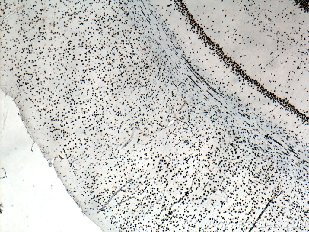 IHC staining of rat brain using 67345-1-Ig