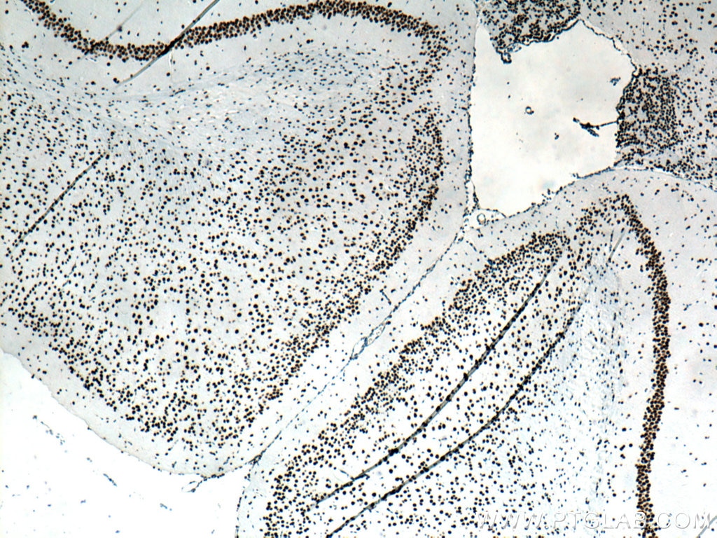 Immunohistochemistry (IHC) staining of mouse brain tissue using TDP-43 (C-terminal) Monoclonal antibody (67345-1-Ig)