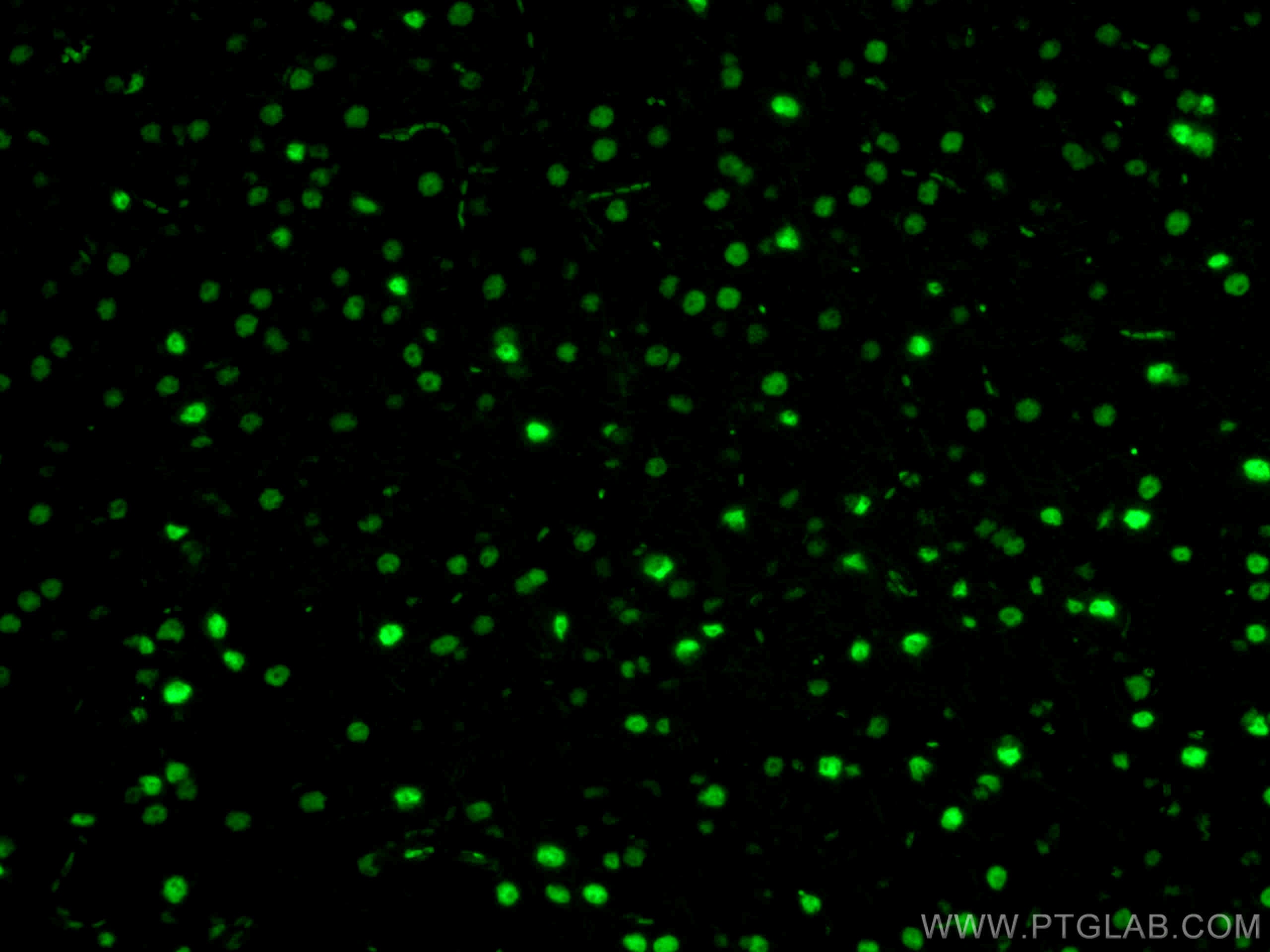 IF Staining of mouse brain using CL488-80002